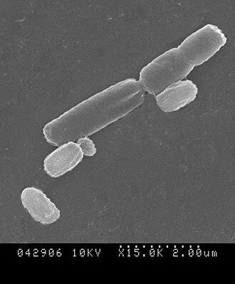 330px-bacillus_subtilis_r0179 Các chủng lợi khuẩn trong Magnet Gold giúp bảo vệ và tối ưu hóa hệ tiêu hóa của ốc
